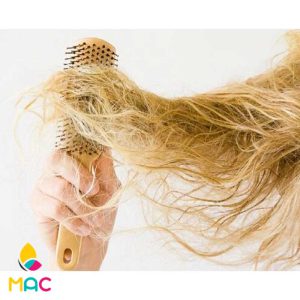 1 علت وز شدن مو و راه‌های جلوگیری از آن