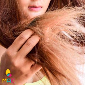 3 علت وز شدن مو و راه‌های جلوگیری از آن